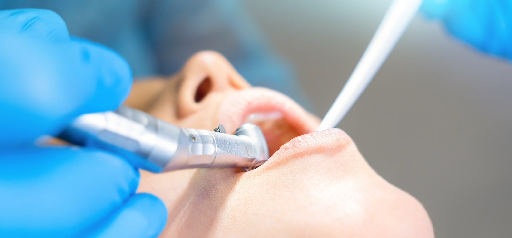 Dental patient undergoing a tooth extraction in Lincoln Park